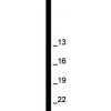 Prebena Stauchkopfnägel JA30CNK