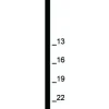 Prebena Stauchkopfnägel JA16CNK